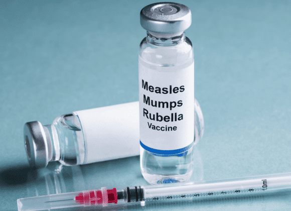 Measles-outbreak-1