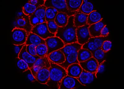 microscopy image of pancreatic cancer cells