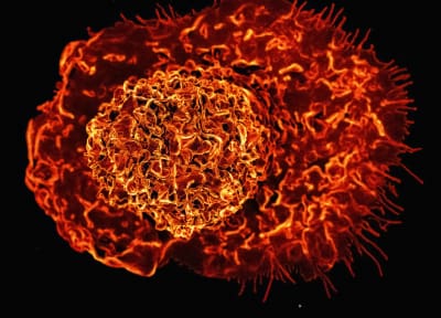 Scanning electron micrograph of a macrophage from National Institute of Allergy and Infectious Diseases Scanning electron micrograph of a macrophage