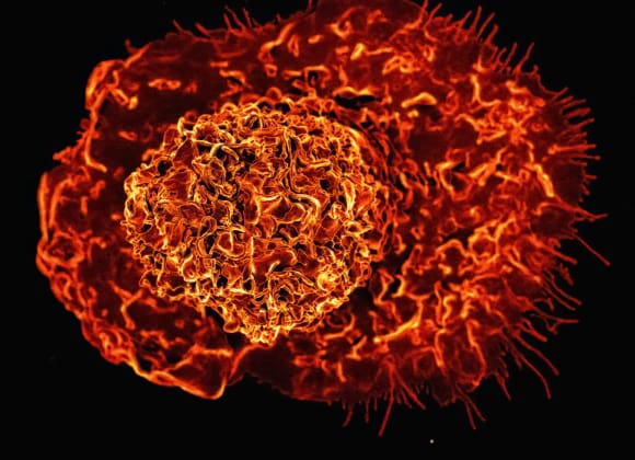 Scanning electron micrograph of a macrophage